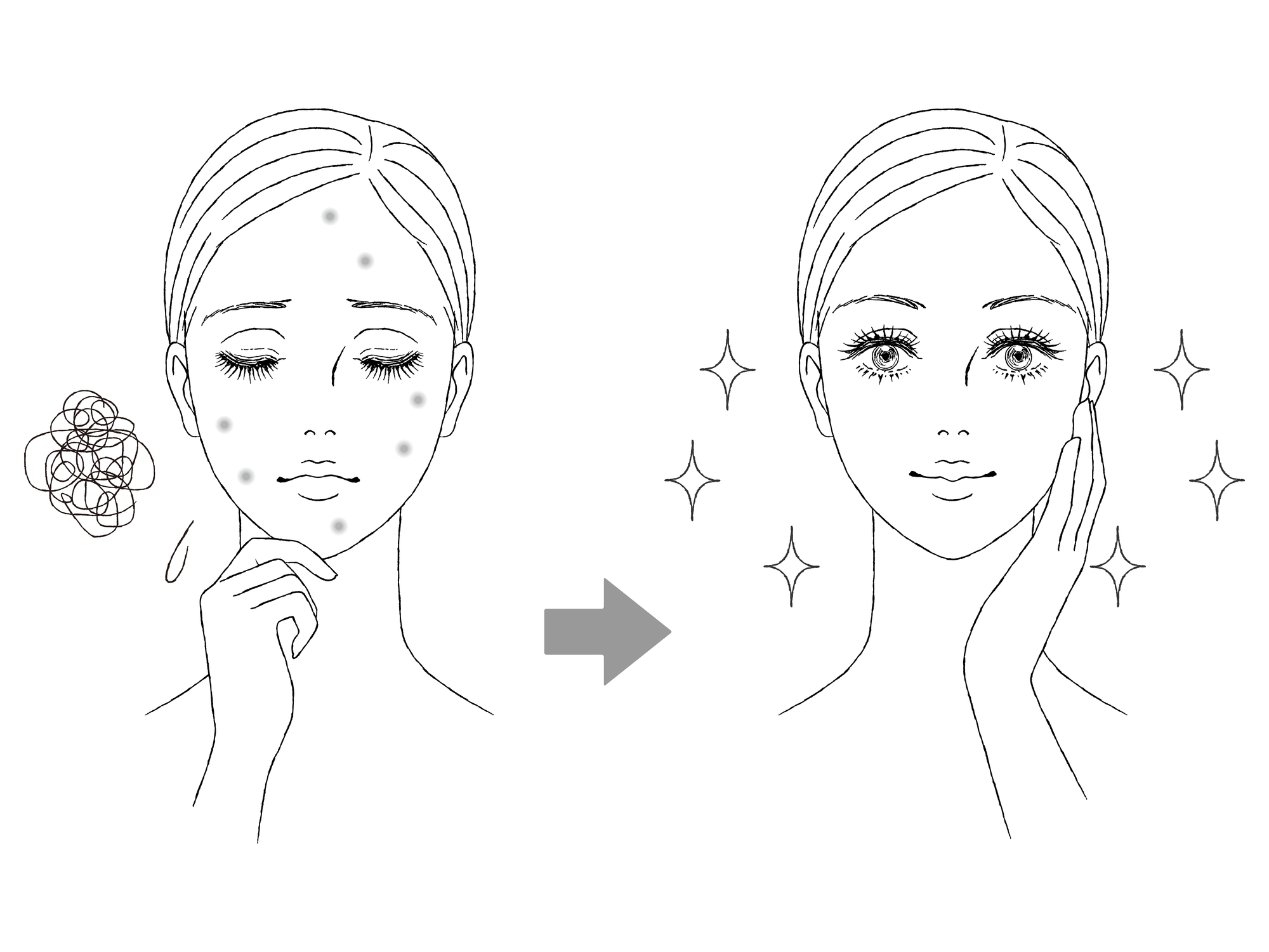 美容皮膚科でできるニキビ治療にはどんなものがあるの？治療法を解説